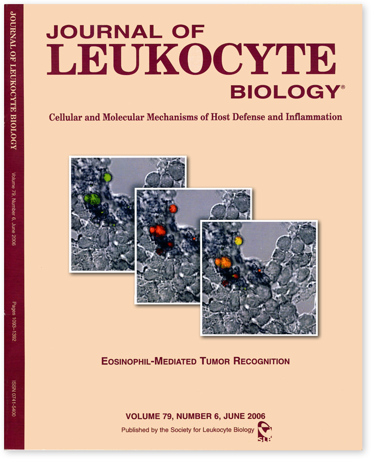ÐÐ°ÑÑÐ¸Ð½ÐºÐ¸ Ð¿Ð¾ Ð·Ð°Ð¿ÑÐ¾ÑÑ Journal of Leukocyte Biology
